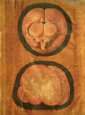 Anatomical drawing of the human brain